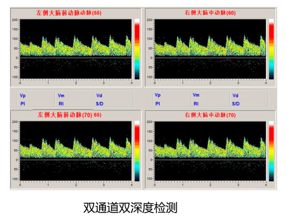 KJ-2V6M多普勒雙通道雙深度檢測(cè)圖.jpg